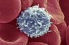Znanstveniki so našli način, povzroča celice T, da začne boj proti raku