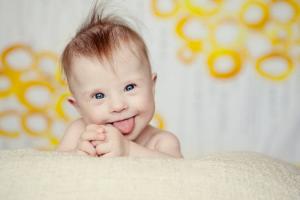 12 značilnosti otrok z Downovim sindromom