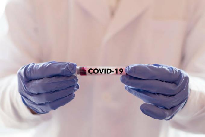 Potrjen nov način okužbe s koronavirusom