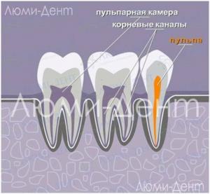 Kako najti in zdraviti zobne kanale v Lumidentu