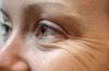 Kako preprečiti nastanek gub okoli oči
