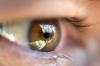 Odstop mrežnice oči: kako rešiti vid?