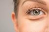 Vrečke pod očmi: kozmetičarka svetuje, kako se znebiti