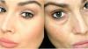 5 Stari recepti za pomoč, da je videti svež in elastično kožo okrog oči in mladi