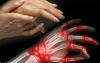 Simptomi in vzroki revmatoidnega artritisa kot opozarjajo