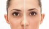 4 zmogljiva orodja, da se znebite pore na obrazu