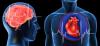 Srčni napad in kap: 7 glavnih napak, ki jih povzročijo