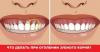 Kako za zdravljenje dlesni, ko postanejo zobje gole vratu?