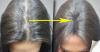 Kako ustaviti izpadanje las in postal lastnik razkošne kodre